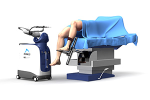 Mako Robotic-Arm Assisted Partial Knee Replacement 