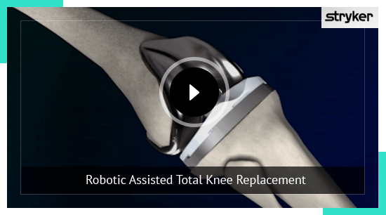 Total Knee Replacement