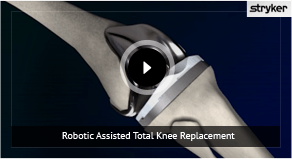 Total Knee Replacement